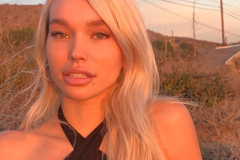 Meet Rara Knupps: A 2024 Profile on Age, Wealth, and Career